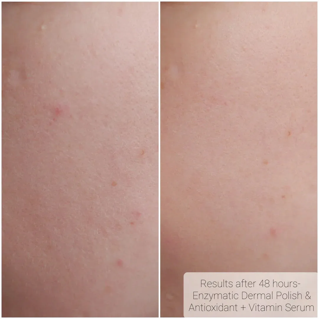 Bright Daily Serum - Vitamin C, Ferulic Acid & Hyaluronic Acid