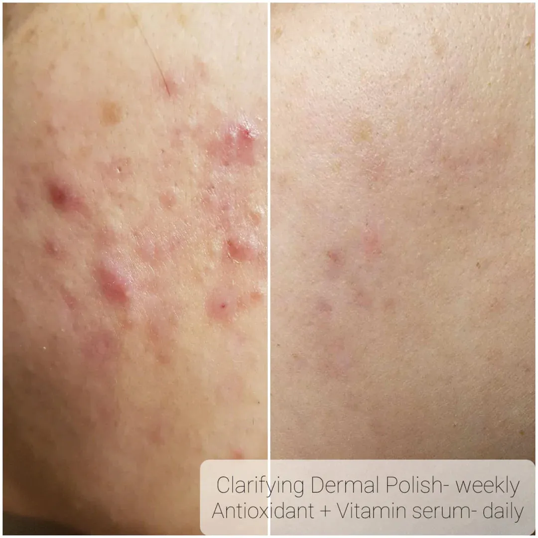 Bright Daily Serum - Vitamin C, Ferulic Acid & Hyaluronic Acid