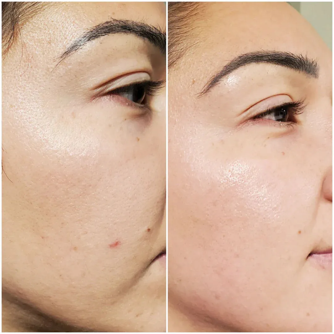 Bright Daily Serum - Vitamin C, Ferulic Acid & Hyaluronic Acid